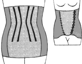 Difference Between Girdle and Corset
